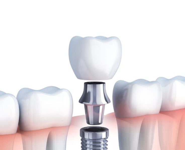 Wakankar Dental