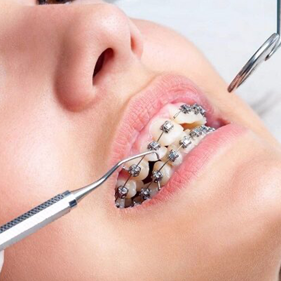 Wakankar Dental