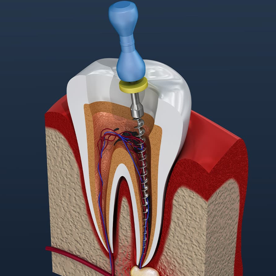 Wakankar Dental