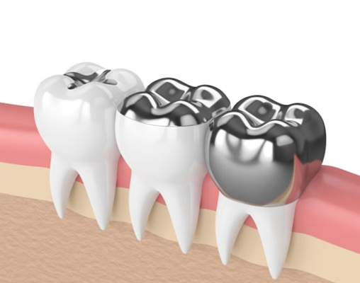 Wakankar Dental