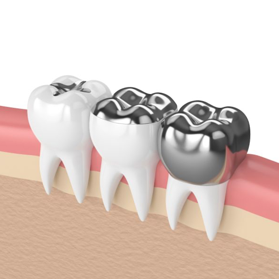 Wakankar Dental