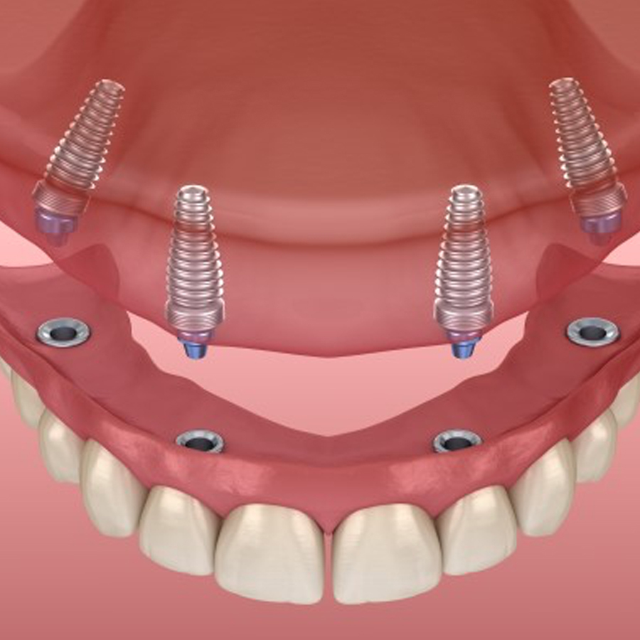 Wakankar Dental