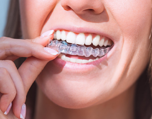 Wakankar Dental