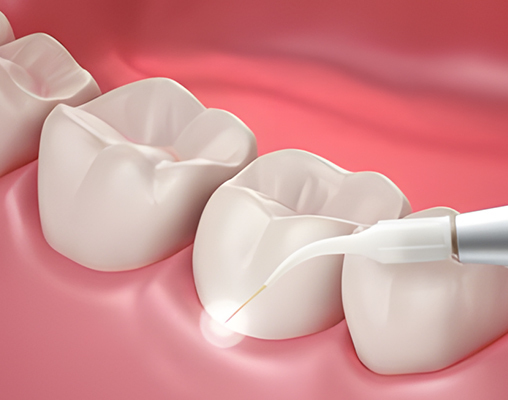Wakankar Dental