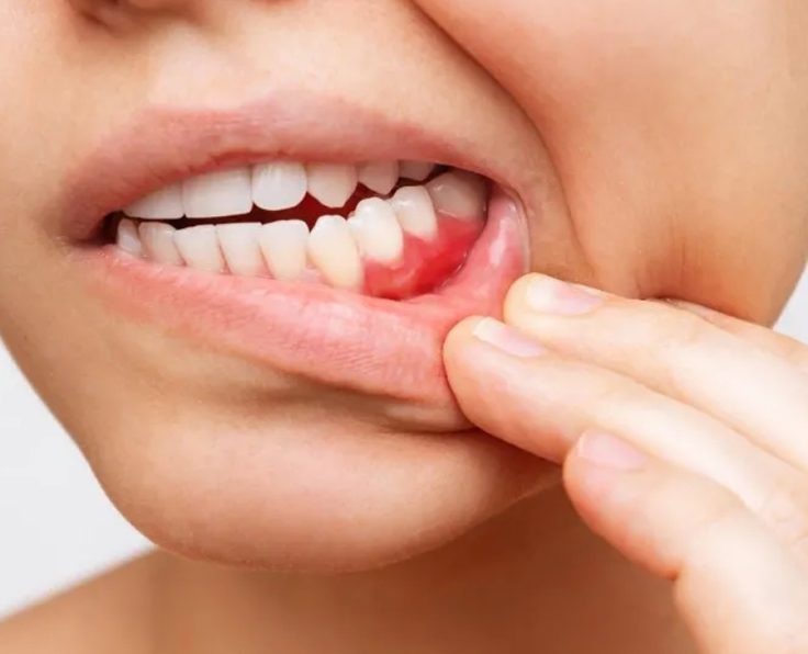 Wakankar Dental