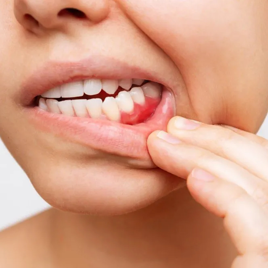 Wakankar Dental