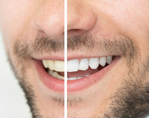 Wakankar Dental