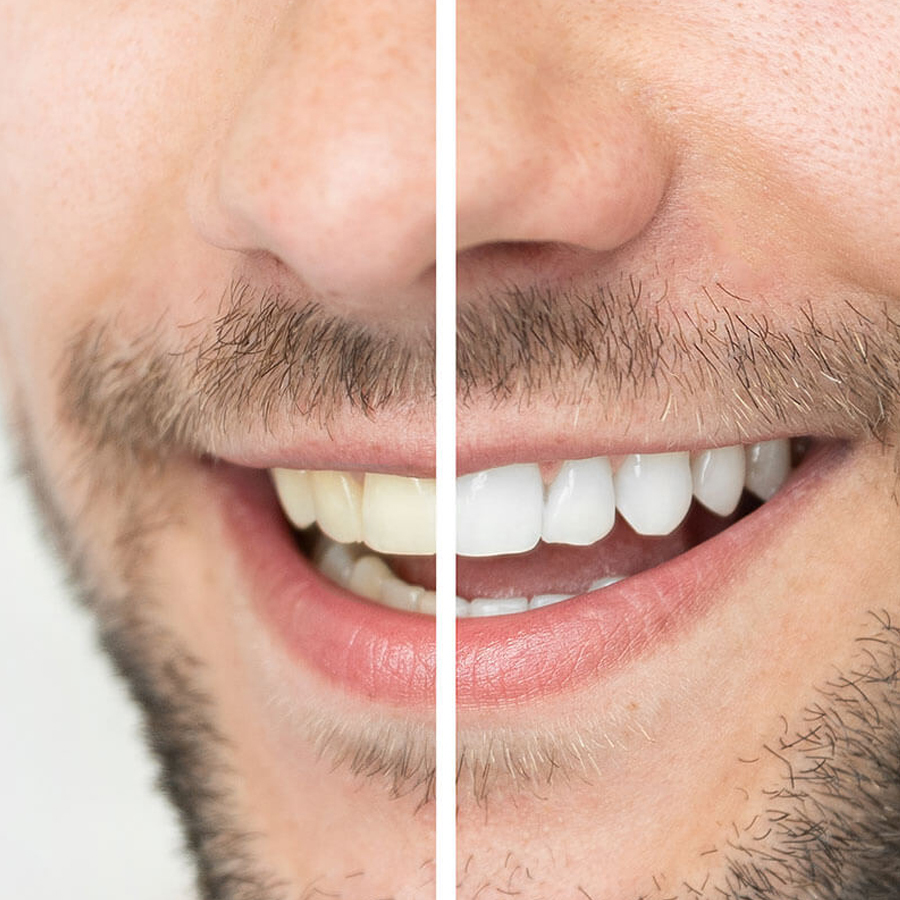 Wakankar Dental