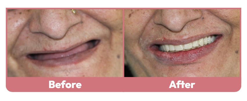 Wakankar Dental