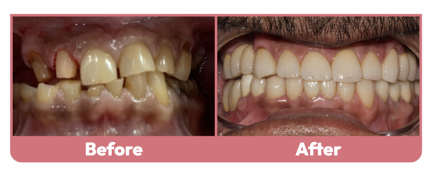 Wakankar Dental