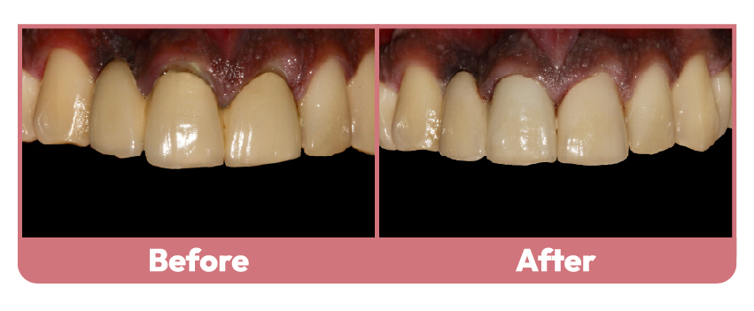 Wakankar Dental