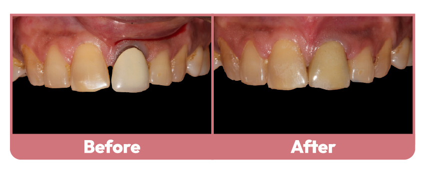 Wakankar Dental
