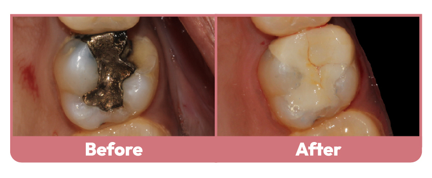 WD_Before after images_Dec'24 2 (1)